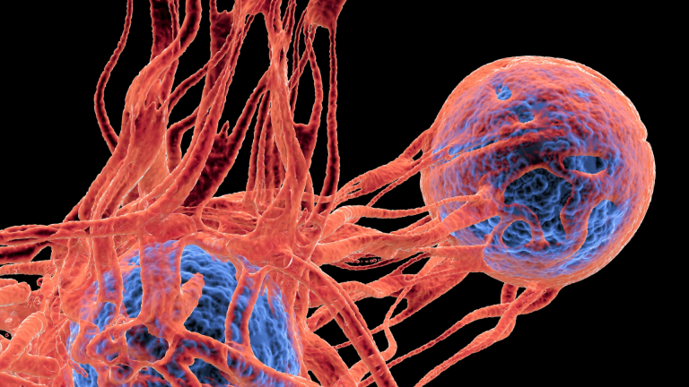 Benign And Malignant Tumours: Why Is It Essential To Understand The Distinction? – Cancermitr